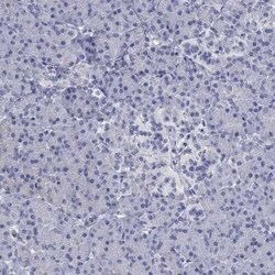 OSTalpha Rabbit anti-Human, Polyclonal, Novus Biologicals 100 &mu;g | Buy Online | Novus Biologicals | Fisher Scientific