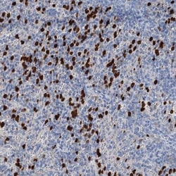 OTOA Antibody, Novus Biologicals 0.1mL; Unlabeled:Antibodies, Polyclonal
