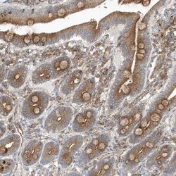 OTOP1 Antibody, Novus Biologicals 25 &mu;L | Buy Online | Novus Biologicals | Fisher Scientific