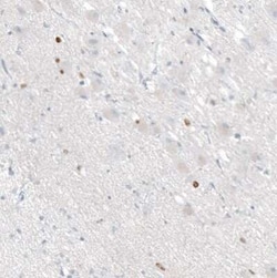 OTP Mouse anti-Human, Rat, Clone: CL11225, Novus Biologicals 100 &mu;g;