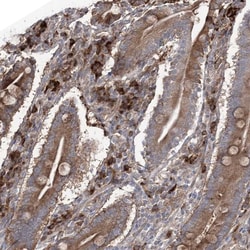 OTUD1 Antibody, Novus Biologicals 25 &mu;L | Buy Online | Novus Biologicals | Fisher Scientific