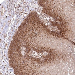OTUD4 Antibody, Novus Biologicals:Antibodies:Primary Antibodies