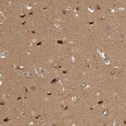 OTUD6B Antibody, Novus Biologicals 25 &mu;L | Buy Online | Novus Biologicals | Fisher Scientific