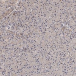 OTUD6B Antibody, Novus Biologicals 25 &mu;L | Buy Online | Novus Biologicals | Fisher Scientific
