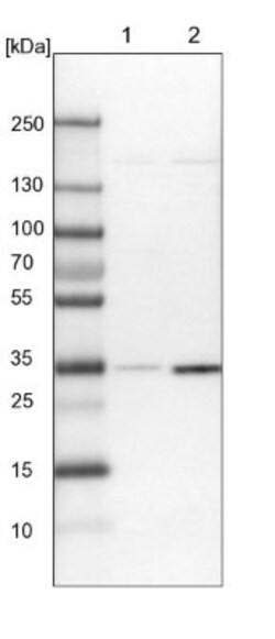 OTUD6B Antibody, Novus Biologicals 25 &mu;L | Buy Online | Novus Biologicals | Fisher Scientific