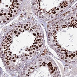 OTUD7A Antibody, Novus Biologicals 0.1mL; Unlabeled:Antibodies, Polyclonal