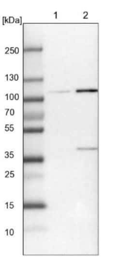 OTUD7B/Cezanne/ZA20D1 Antibody, Novus Biologicals 25 &mu;L; Unlabeled:Antibodies,