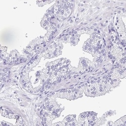OVGP1 Antibody, Novus Biologicals 0.1mL; Unlabeled:Antibodies, Polyclonal