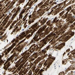 OXCT1 Antibody, Novus Biologicals 0.1 mL | Buy Online | Novus Biologicals | Fisher Scientific