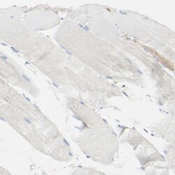 OXCT1 Antibody, Novus Biologicals 0.1 mL | Buy Online | Novus Biologicals | Fisher Scientific