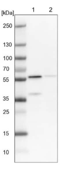 OXCT1 Antibody, Novus Biologicals 0.1 mL | Buy Online | Novus Biologicals | Fisher Scientific