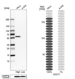 OXCT1 Antibody, Novus Biologicals 0.1 mL | Buy Online | Novus Biologicals | Fisher Scientific