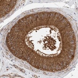 Cytochrome P450 2C9 Antibody, Novus Biologicals:Antibodies:Primary Antibodies