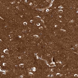 Cytochrome P450 2C9 Antibody, Novus Biologicals:Antibodies:Primary Antibodies