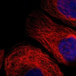 OXSM Antibody, Novus Biologicals:Antibodies:Primary Antibodies