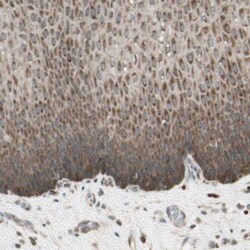 OXSR1 Antibody, Novus Biologicals 0.1mL; Unlabeled:Antibodies, Polyclonal