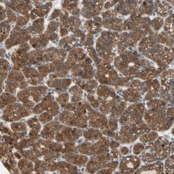 OXSR1 Antibody, Novus Biologicals 0.1mL; Unlabeled:Antibodies, Polyclonal
