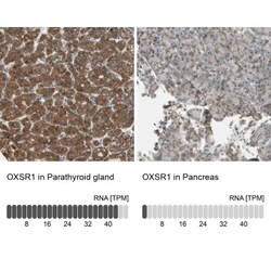 OXSR1 Antibody, Novus Biologicals 0.1mL; Unlabeled:Antibodies, Polyclonal