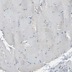 Occludin Antibody, Novus Biologicals:Antibodies:Primary Antibodies