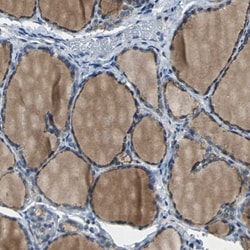 Occludin Antibody, Novus Biologicals:Antibodies:Primary Antibodies