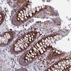 Olfactomedin-2/Noelin-2 Antibody, Novus Biologicals 25 &mu;L, Unlabeled:Antibodies,