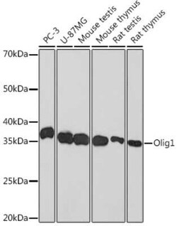 Olig1 Rabbit anti-Human, Mouse, Rat, Clone: 7E4B2, Novus Biologicals:Antibodies:Primary