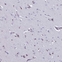 Olig2 Antibody, Novus Biologicals:Antibodies:Primary Antibodies