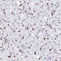 Olig2 Antibody, Novus Biologicals:Antibodies:Primary Antibodies