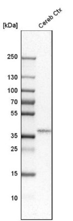 Olig2 Antibody, Novus Biologicals:Antibodies:Primary Antibodies