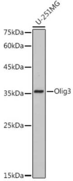 Olig3 Rabbit anti-Human, Clone: 9C1N3, Novus Biologicals 100 &mu;g | Buy Online | Novus Biologicals | Fisher Scientific