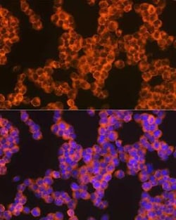 Oncostatin M/OSM Rabbit anti-Human, Mouse, Rat, Clone: 8O8K9, Novus Biologicals:Antibodies:Primary