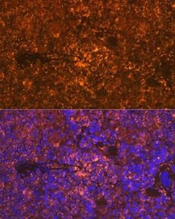 Oncostatin M/OSM Rabbit anti-Human, Mouse, Rat, Clone: 8O8K9, Novus Biologicals:Antibodies:Primary
