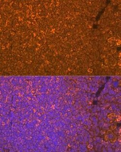 Oncostatin M/OSM Rabbit anti-Human, Mouse, Rat, Clone: 8O8K9, Novus Biologicals:Antibodies:Primary