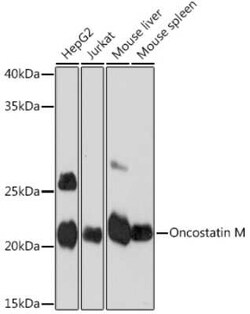 Oncostatin M/OSM Rabbit anti-Human, Mouse, Rat, Clone: 8O8K9, Novus Biologicals:Antibodies:Primary