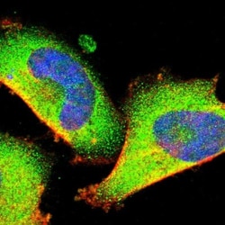 Optineurin Antibody, Novus Biologicals 0.1mL; Unlabeled:Antibodies, Polyclonal