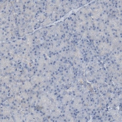 Optineurin Antibody, Novus Biologicals 0.1mL; Unlabeled:Antibodies, Polyclonal