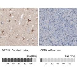 Optineurin Antibody, Novus Biologicals 0.1mL; Unlabeled:Antibodies, Polyclonal