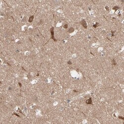 Optineurin Antibody, Novus Biologicals:Antibodies:Primary Antibodies