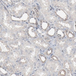 Optineurin Antibody, Novus Biologicals:Antibodies:Primary Antibodies
