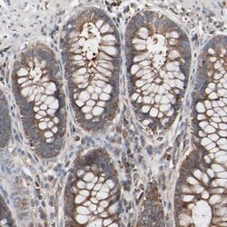 Optineurin Antibody, Novus Biologicals:Antibodies:Primary Antibodies