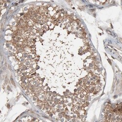 Optineurin Antibody, Novus Biologicals:Antibodies:Primary Antibodies