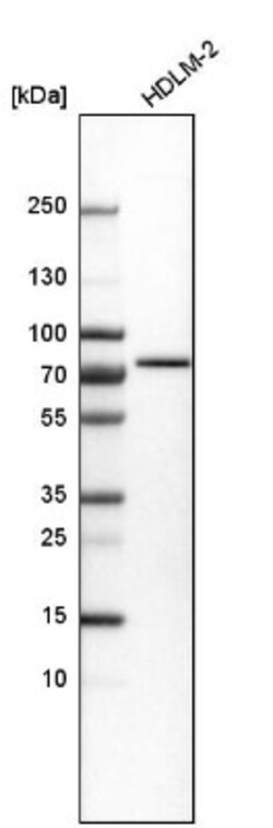 Optineurin Antibody, Novus Biologicals 0.1mL; Unlabeled:Antibodies, Polyclonal