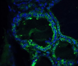 Orai1 Antibody - BSA Free, Novus Biologicals 0.1mg; Unlabeled:Antibodies,
