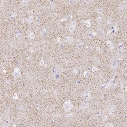 Orexin R2/HCRTR2 Antibody, Novus Biologicals:Antibodies:Primary Antibodies