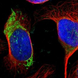 Ornithine Carbamoyltransferase Antibody, Novus Biologicals 0.1mL; Unlabeled:Antibodies,