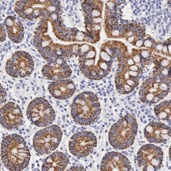 Ornithine Carbamoyltransferase Antibody, Novus Biologicals 0.1mL; Unlabeled:Antibodies,