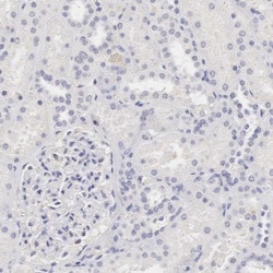 Ornithine Carbamoyltransferase Antibody, Novus Biologicals 0.1mL; Unlabeled:Antibodies,