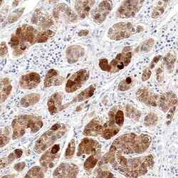 Ornithine Carbamoyltransferase Antibody, Novus Biologicals 0.1mL; Unlabeled:Antibodies,