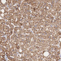 Ornithine Carbamoyltransferase Antibody, Novus Biologicals 0.1mL; Unlabeled:Antibodies,