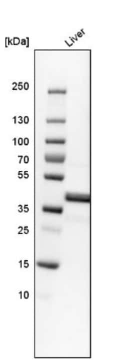 Ornithine Carbamoyltransferase Antibody, Novus Biologicals 0.1mL; Unlabeled:Antibodies,